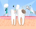 Dentistry. Doctors treat teeth affected by caries. Enamel damage, tooth infection, bacteria. Dentistry, treatment of toothache. Ve